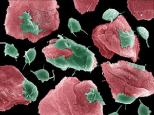 Trichomonas