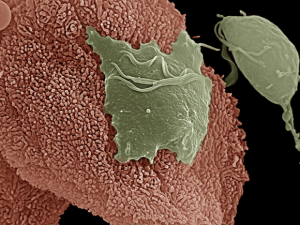 tvaginalis parasite